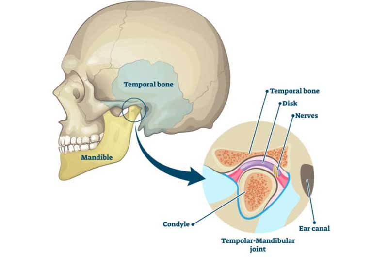 tmj treatment in Delhi